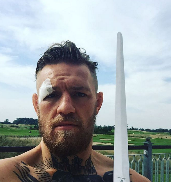 conor mcgregor com olho machucado